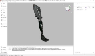 Artec 3D & HP collaborent à la création d’une prothèse révolutionnaire imprimée en 3D
