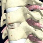 Bentley Systems annonce l’édition d’AutoPIPE Vessel V8i (origine Microprotol)