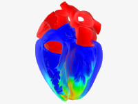 Le projet ‘Living Heart’ de Dassault Systèmes franchit de nouvelles étapes importantes